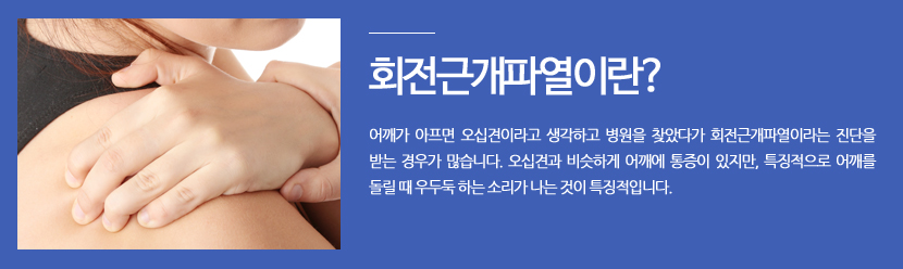 회전근개파열이란? 어깨가 아프면 오십견이라고 생각하고 병원을 찾았다가 회전근개파열이라는 진단을 받는 경우가 많습니다. 오십견과 비슷하게 어깨에 통증이 있지만, 특징적으로 어깨를 돌릴 때 우두둑 하는 소리가 나는 것이 특징적입니다. 