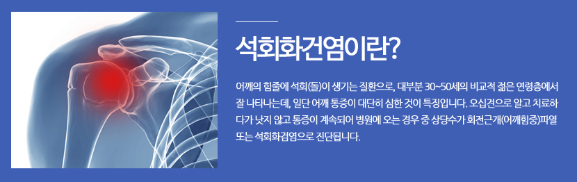 석회화건염이란? 어깨의 힘줄에 석회(돌)이 생기는 질환으로, 대부분 30~50세의 비교적 젊은 연령층에서 잘 나타나는데, 일단 어깨 통증이 대단히 심한 것이 특징입니다. 오십견으로 알고 치료하 다가 낫지 않고 통증이 계속되어 병원에 오는 경우 중 상당수가 회전근개(어깨힘중)파열 또는 석회화검염으로 진단됩니다.