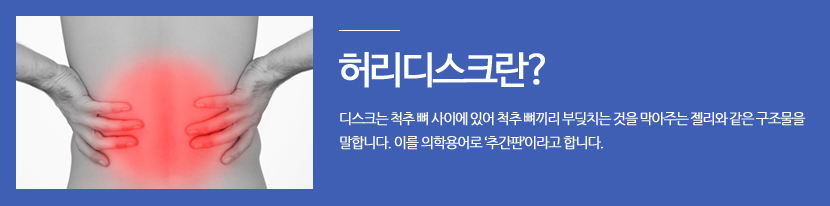 목디스크란? 우리가 흔히 목디스크라고 부르는 경추추간판 탈출증은 목뼈, 즉 경추와 경추 사이의 추간판(디스크) 사이로 내부의 수핵이 빠져나와 신경근이나 척수를 눌러 생기는 것입니다.